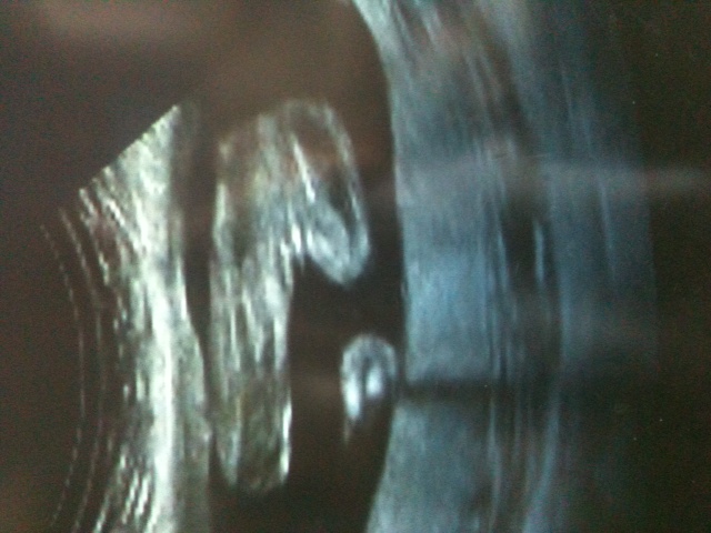 Name:  photo.JPG
Views: 254
Size:  107.3 KB