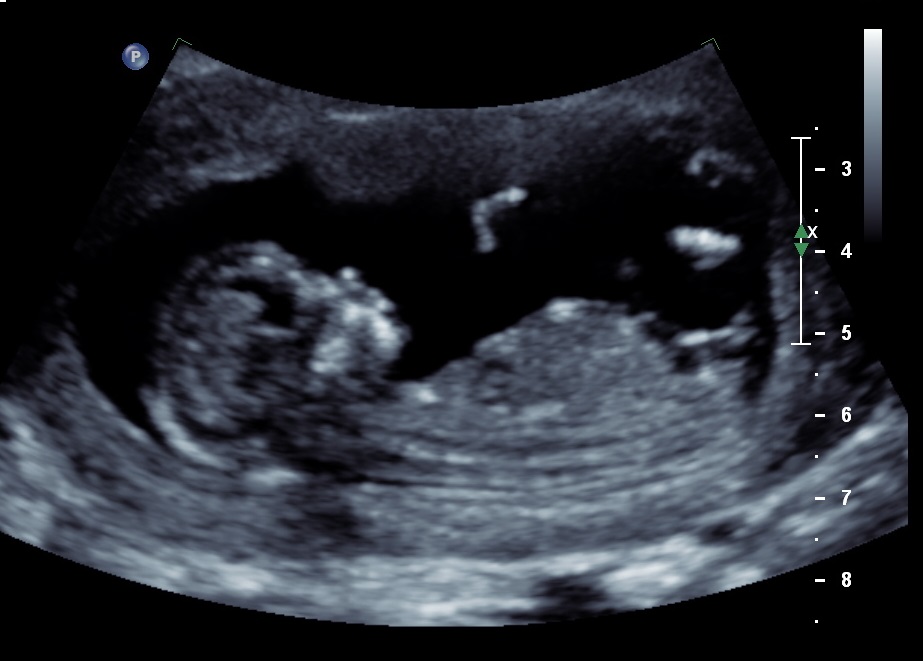 Name:  Baby4.jpg
Views: 141
Size:  99.2 KB