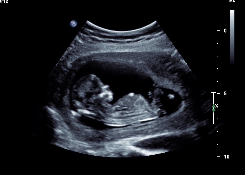 Name:  Baby3.jpg
Views: 179
Size:  92.3 KB