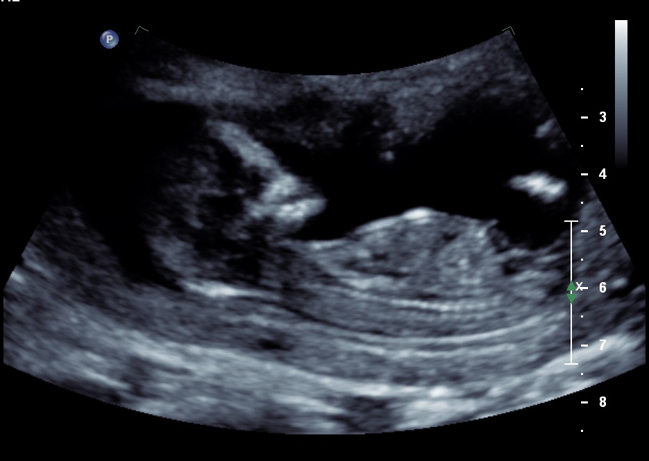 Name:  Baby2.jpg
Views: 168
Size:  97.3 KB