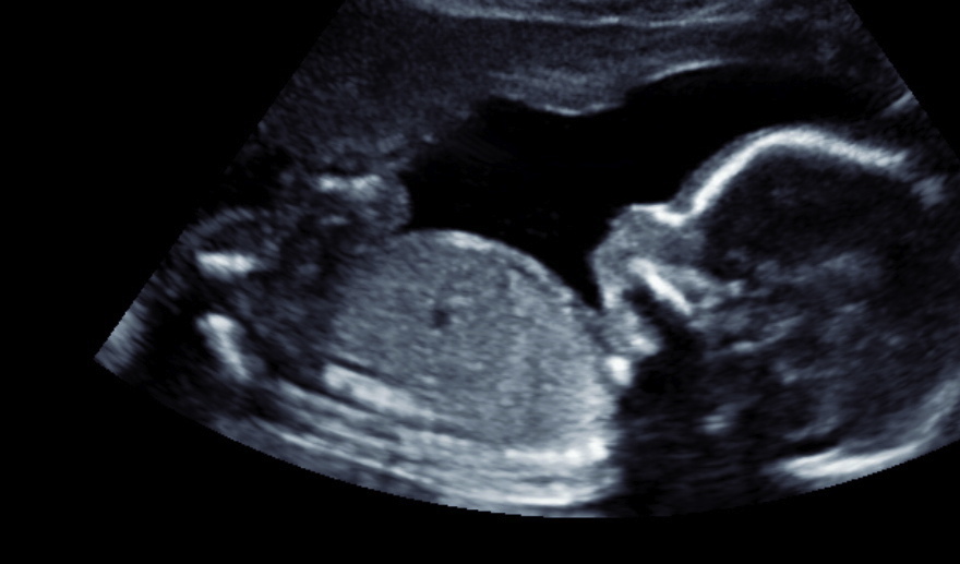 Name:  Mybellybug20weeks.jpg
Views: 5499
Size:  96.8 KB
