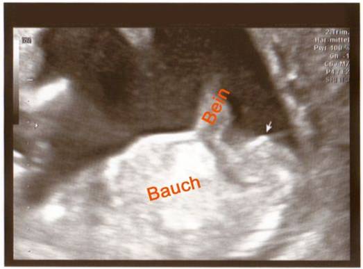 Name:  Bild1.jpg
Views: 397
Size:  23.3 KB