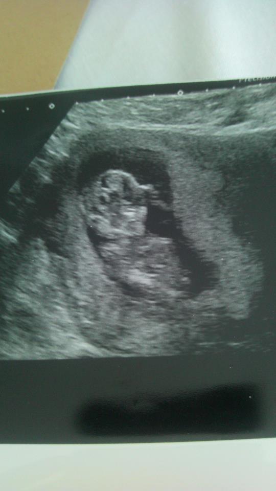 Name:  baby 2.jpg
Views: 72
Size:  41.1 KB