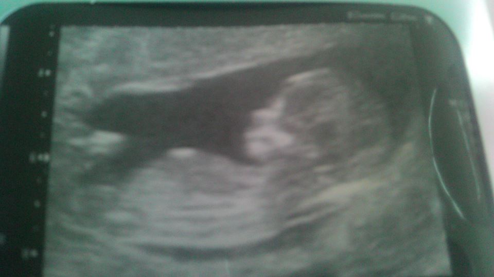 Name:  baby.jpg
Views: 91
Size:  39.3 KB