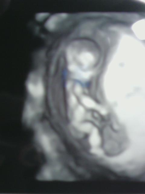 Name:  000baby4.jpg
Views: 428
Size:  16.6 KB