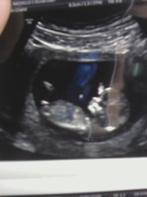 Name:  00baby4.jpg
Views: 431
Size:  22.3 KB