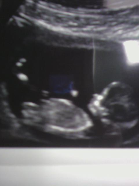 Name:  0baby4.jpg
Views: 402
Size:  18.7 KB
