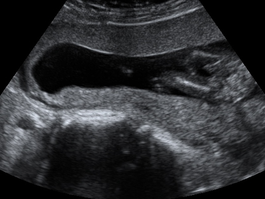 Name:  BABY_33.JPG
Views: 218
Size:  112.7 KB