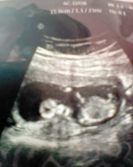 Name:  CIMG0050.jpg
Views: 148
Size:  38.9 KB