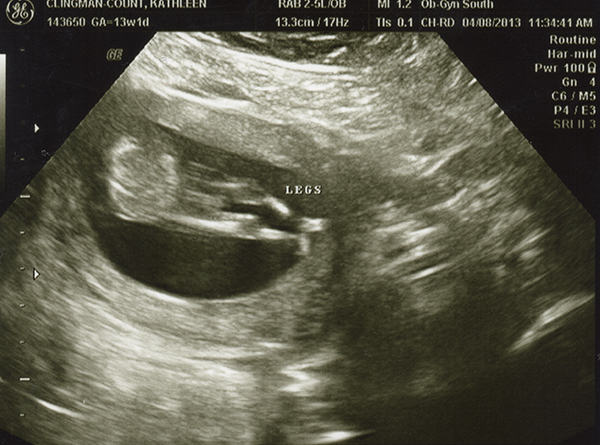 Name:  13weekUS01.jpg
Views: 169
Size:  247.1 KB