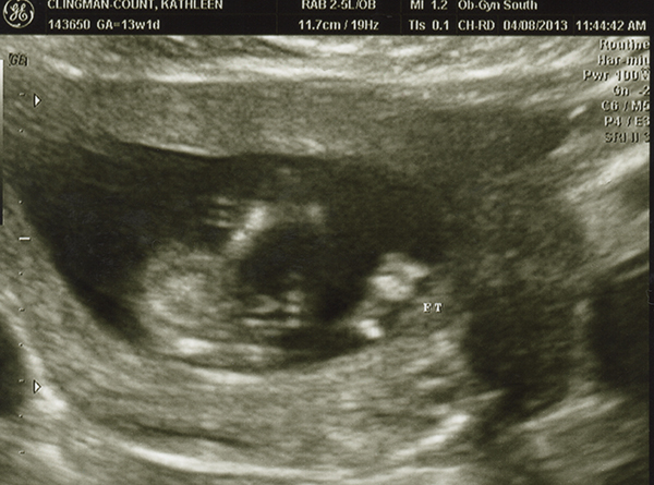 Name:  13weekUS07.jpg
Views: 167
Size:  226.5 KB