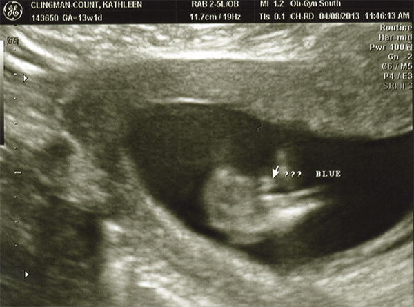 Name:  13weekUS08.jpg
Views: 166
Size:  232.6 KB