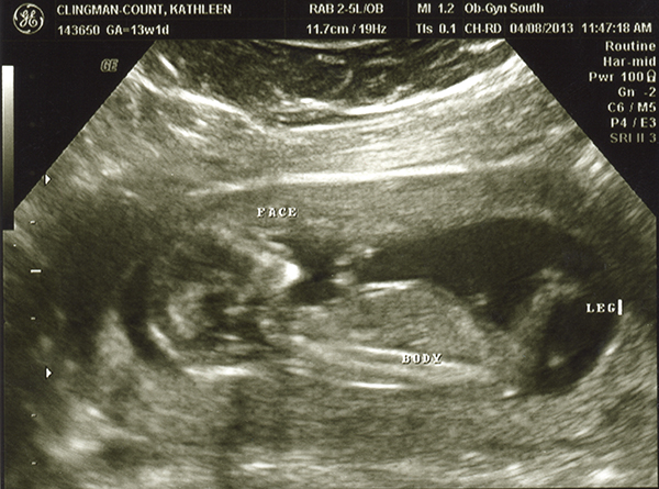 Name:  13weekUS09.jpg
Views: 169
Size:  262.6 KB