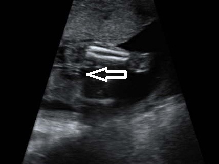 Name:  BABY_8.jpg
Views: 1326
Size:  45.4 KB