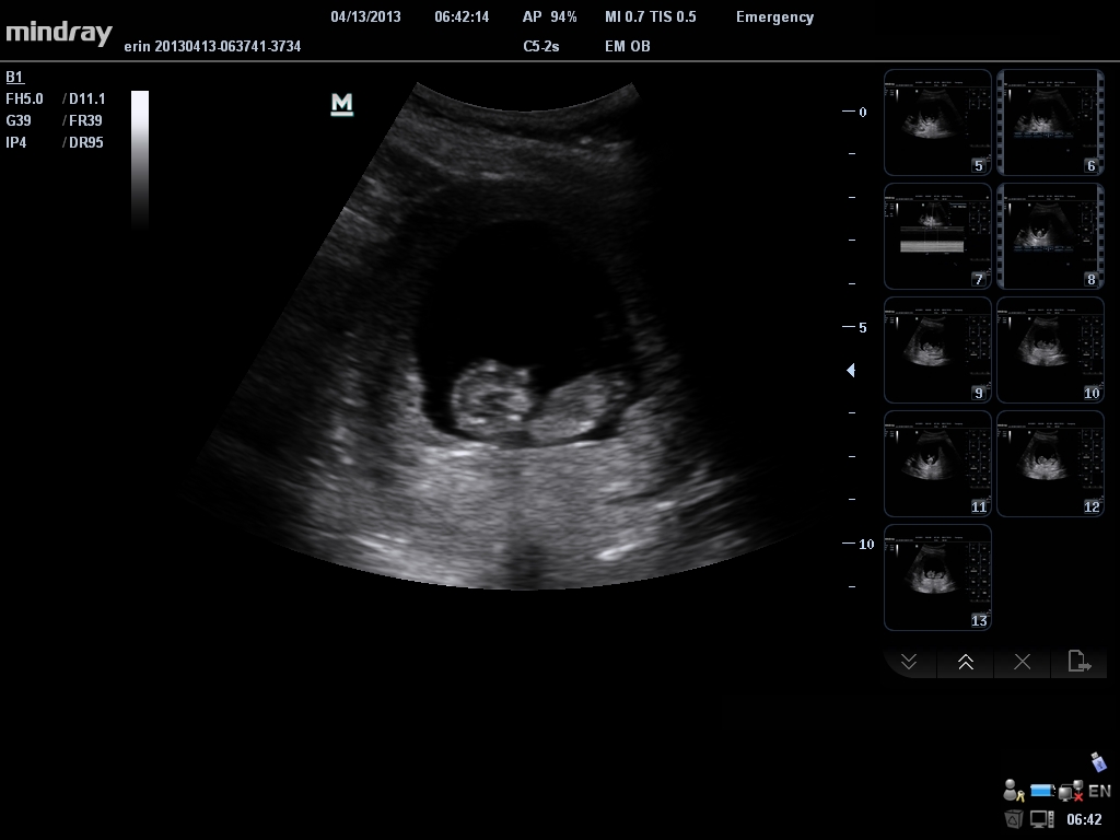 Name:  201304130642140024EM OB.JPG
Views: 126
Size:  182.9 KB