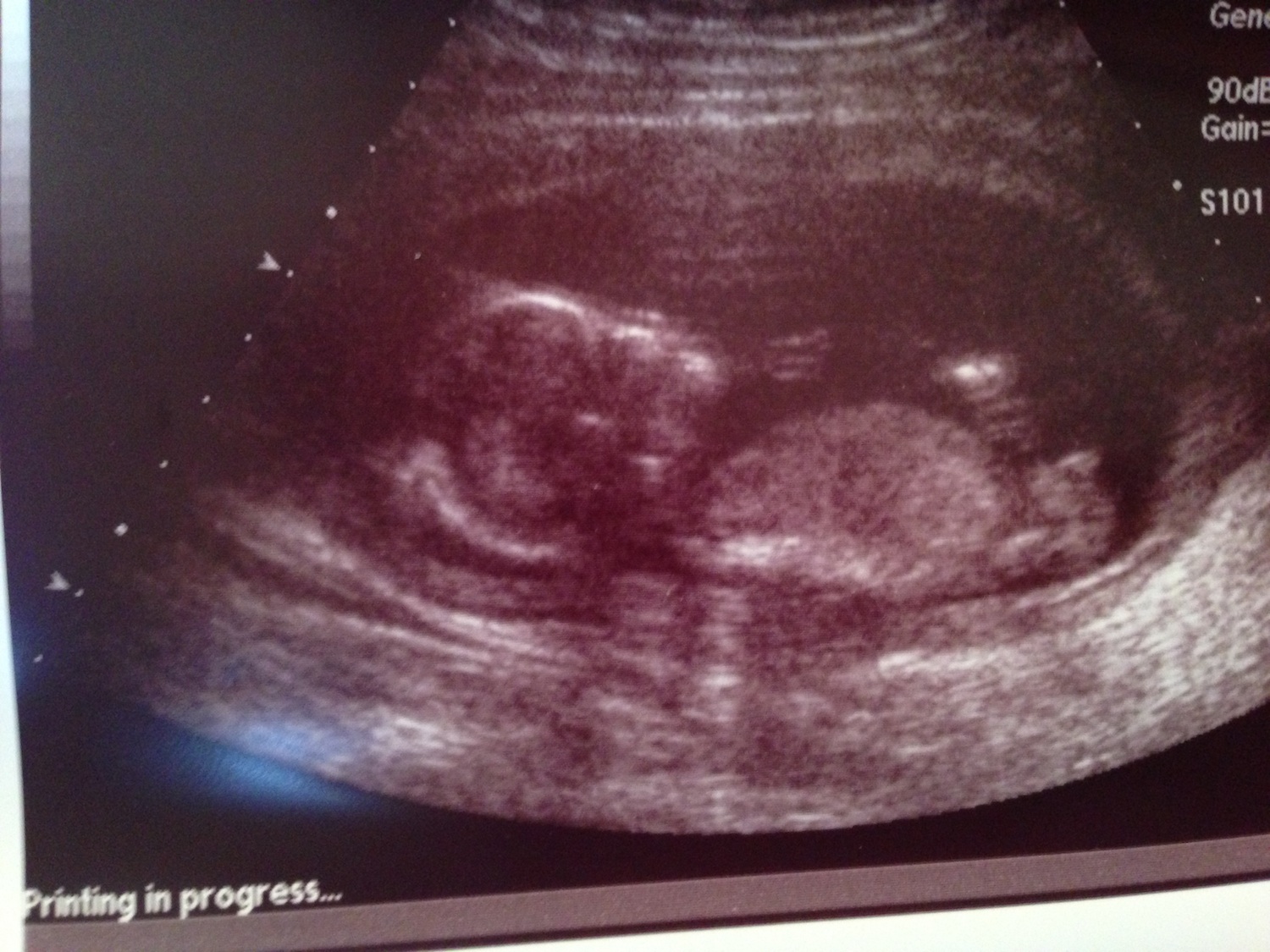 Name:  babynub.jpg
Views: 2186
Size:  441.4 KB
