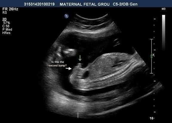 Name:  boysnail.jpg
Views: 16899
Size:  39.5 KB