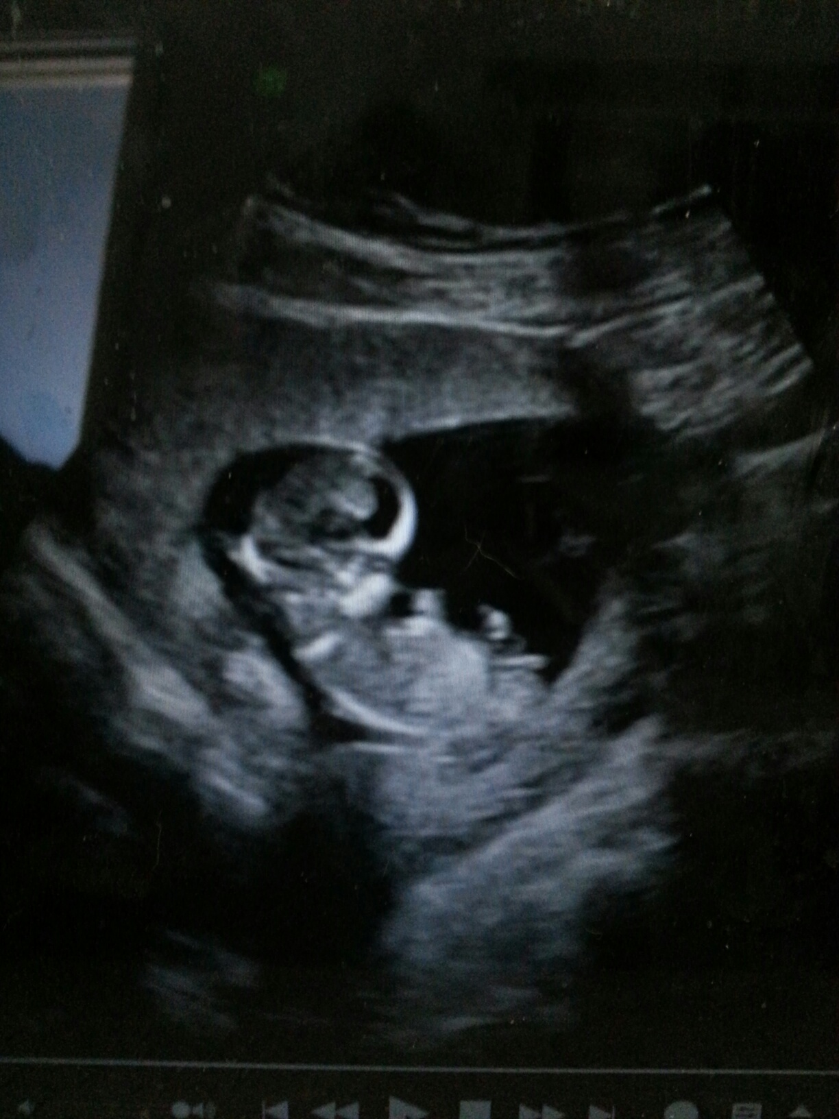 Name:  baby center nub guess 1.jpg
Views: 1724
Size:  442.4 KB
