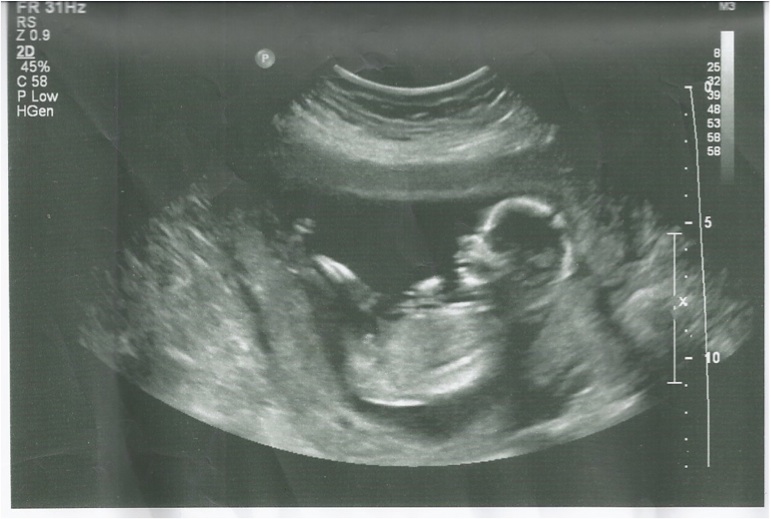 Name:  baby2.jpg
Views: 609
Size:  99.3 KB