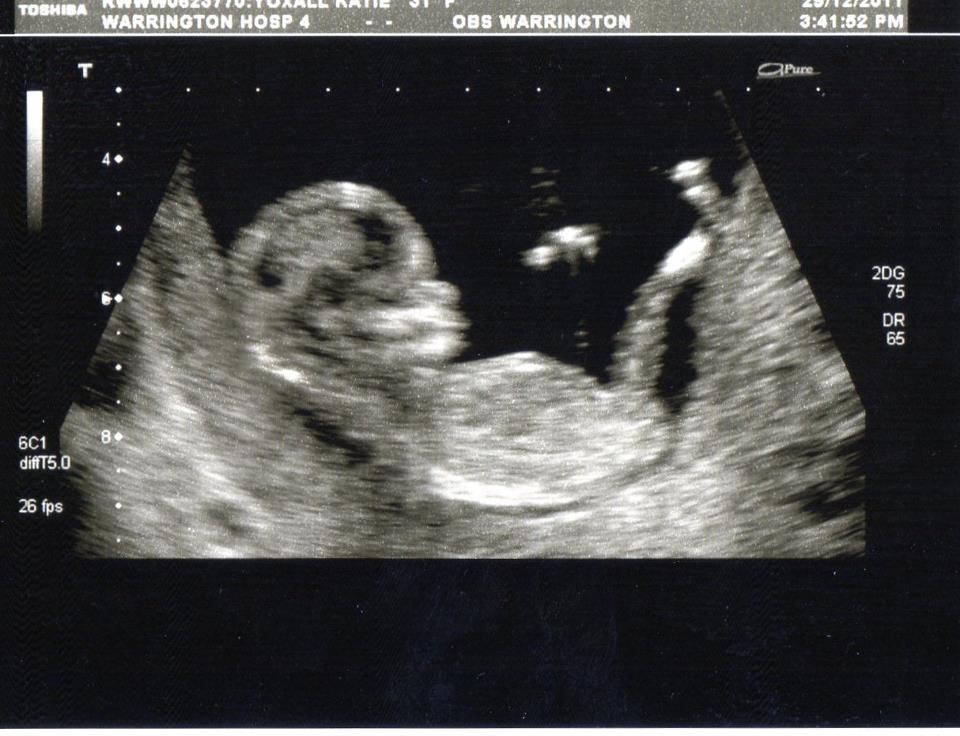 Name:  scan.jpg
Views: 322
Size:  85.6 KB