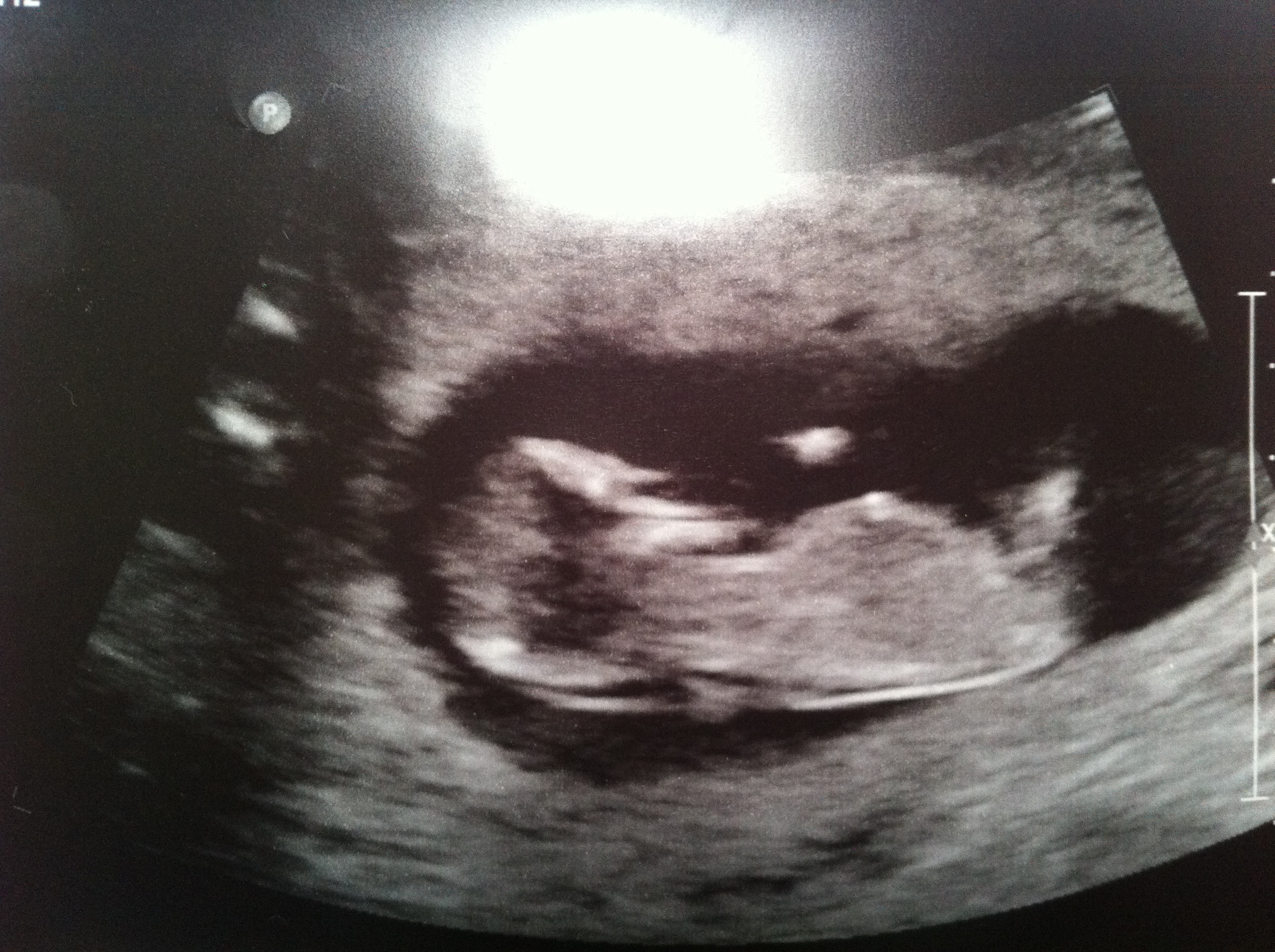 Name:  baby 12w6d pic1.JPG
Views: 266
Size:  1.86 MB