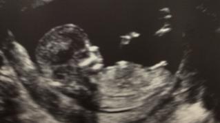 Name:  baby 1.jpg
Views: 139
Size:  7.4 KB