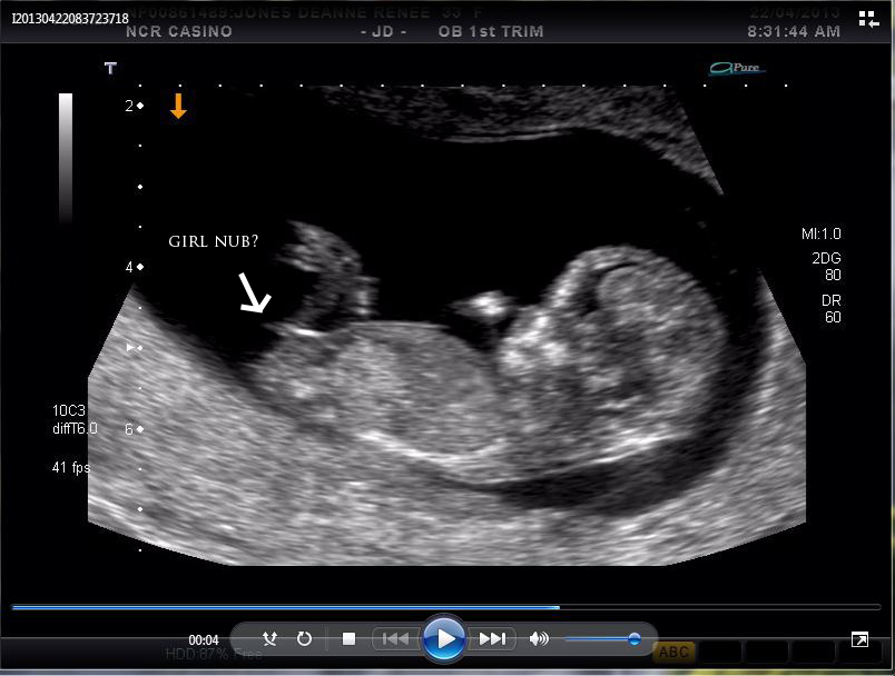 Name:  Nubshot.JPG
Views: 134
Size:  174.2 KB