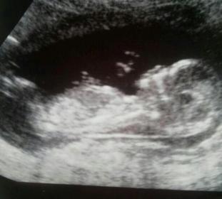 Name:  baby.jpg
Views: 108
Size:  11.9 KB
