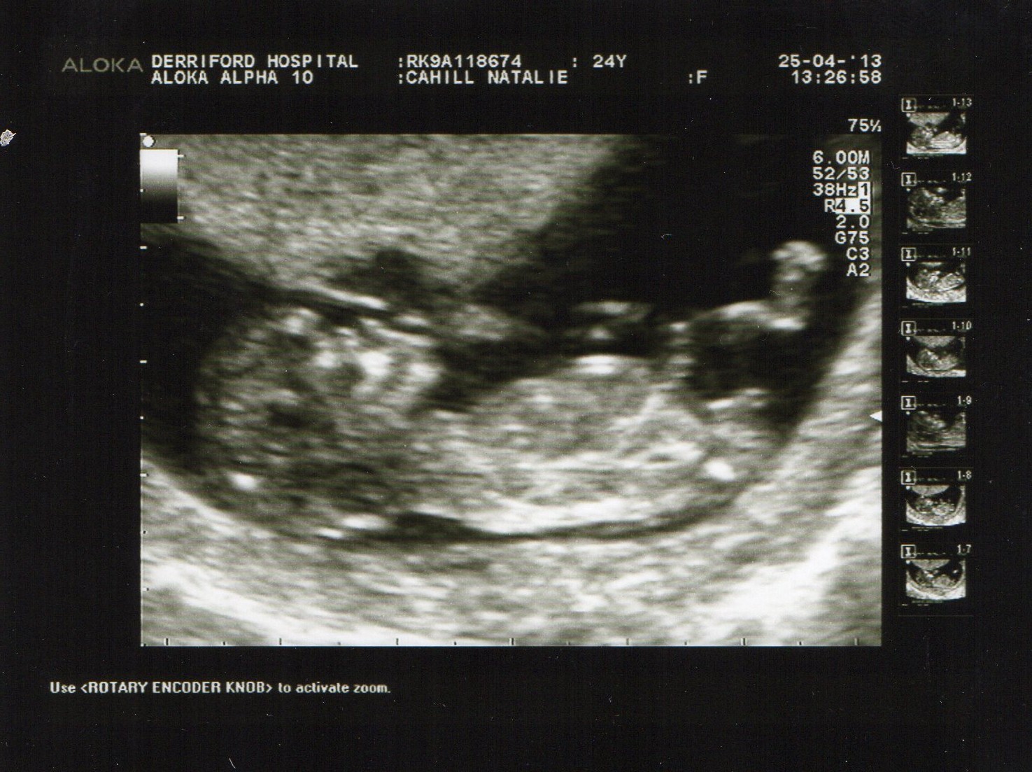 Name:  Baby Cahill2.jpg
Views: 151
Size:  383.7 KB