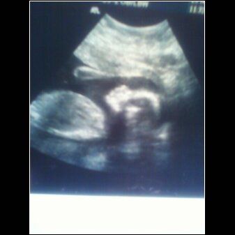 Name:  austin 13wks.jpg
Views: 333
Size:  12.1 KB