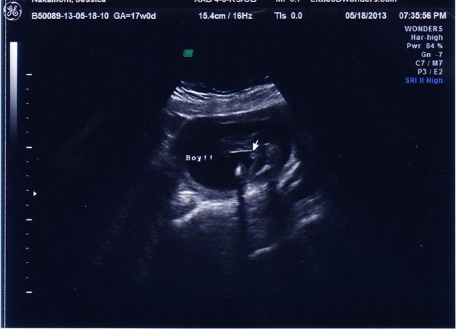 Name:  ultrasound.jpg
Views: 165
Size:  29.2 KB