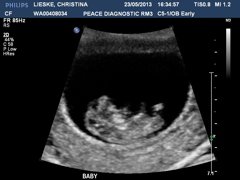 Name:  LIESKECHRISTINA20130523163458345.jpg
Views: 168
Size:  142.0 KB