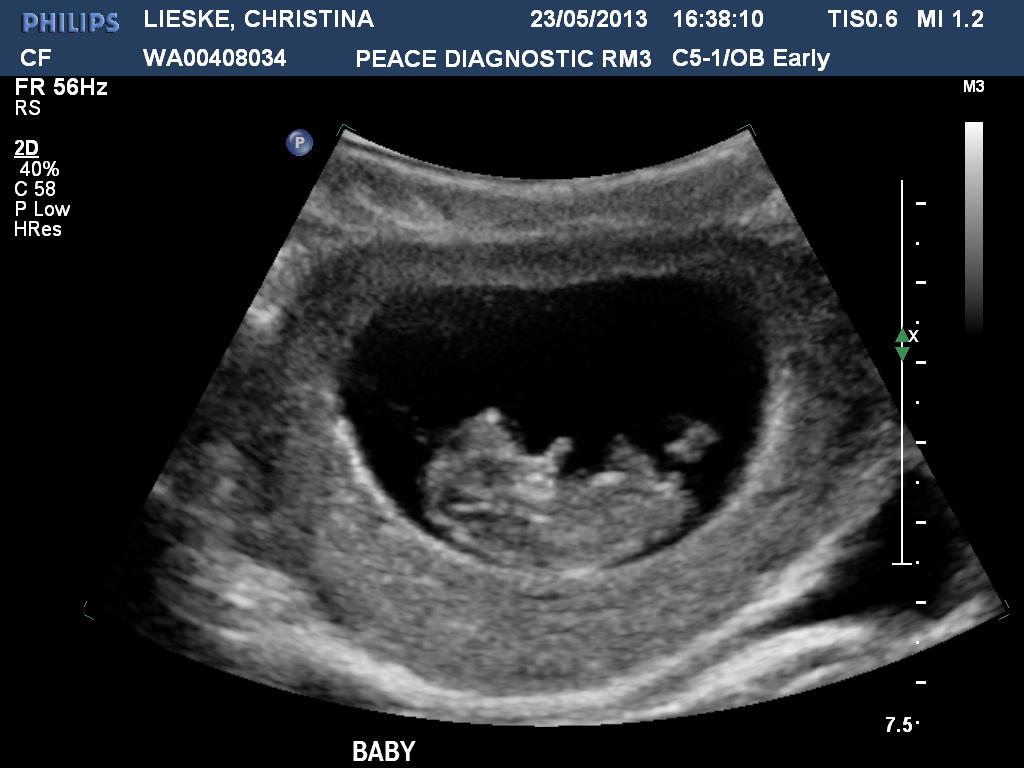 Name:  LIESKECHRISTINA20130523163811383.jpg
Views: 158
Size:  165.4 KB