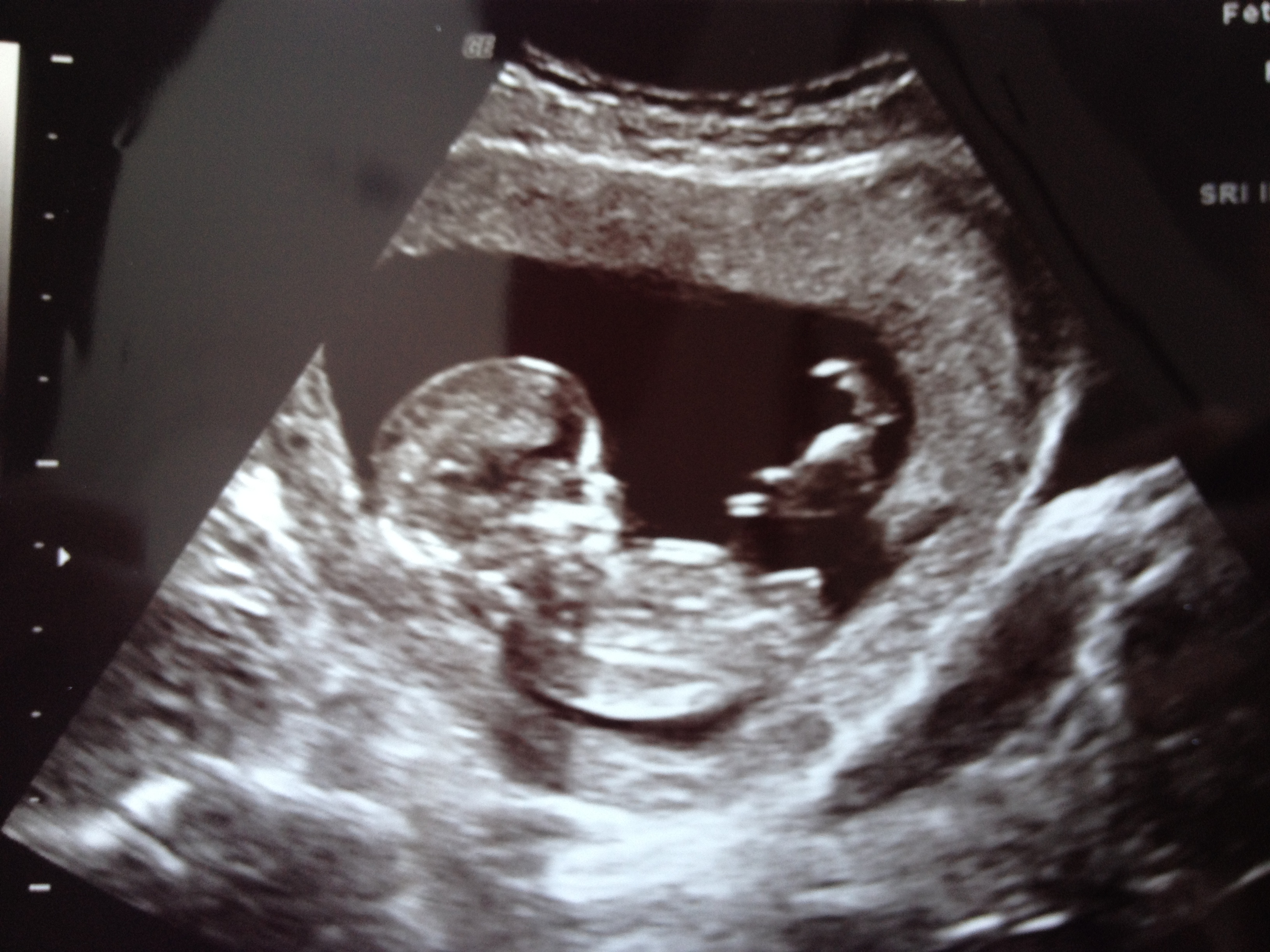 Name:  photo 2 (8).JPG
Views: 327
Size:  2.08 MB