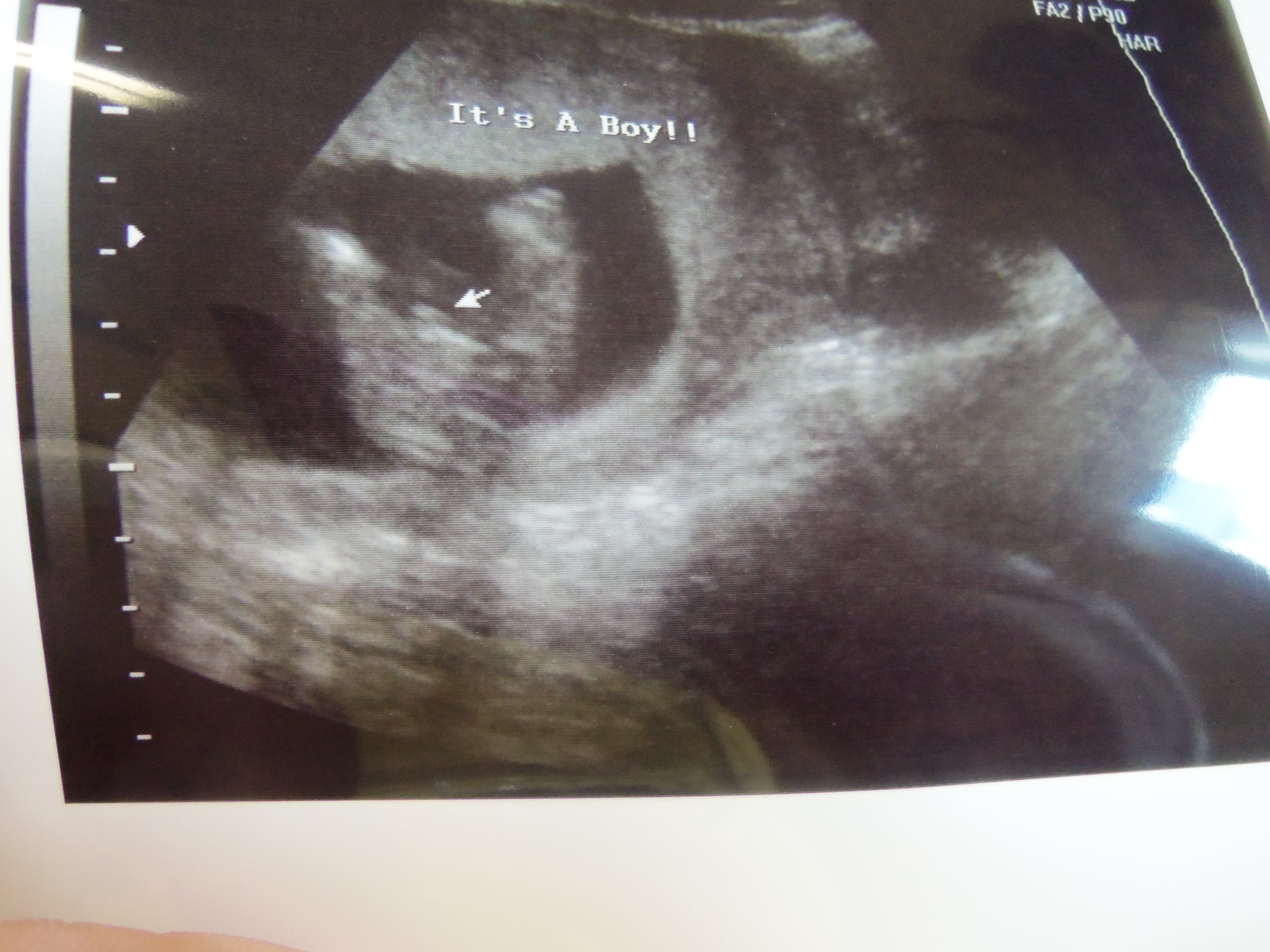 Name:  100_3820.JPG
Views: 231
Size:  2.86 MB