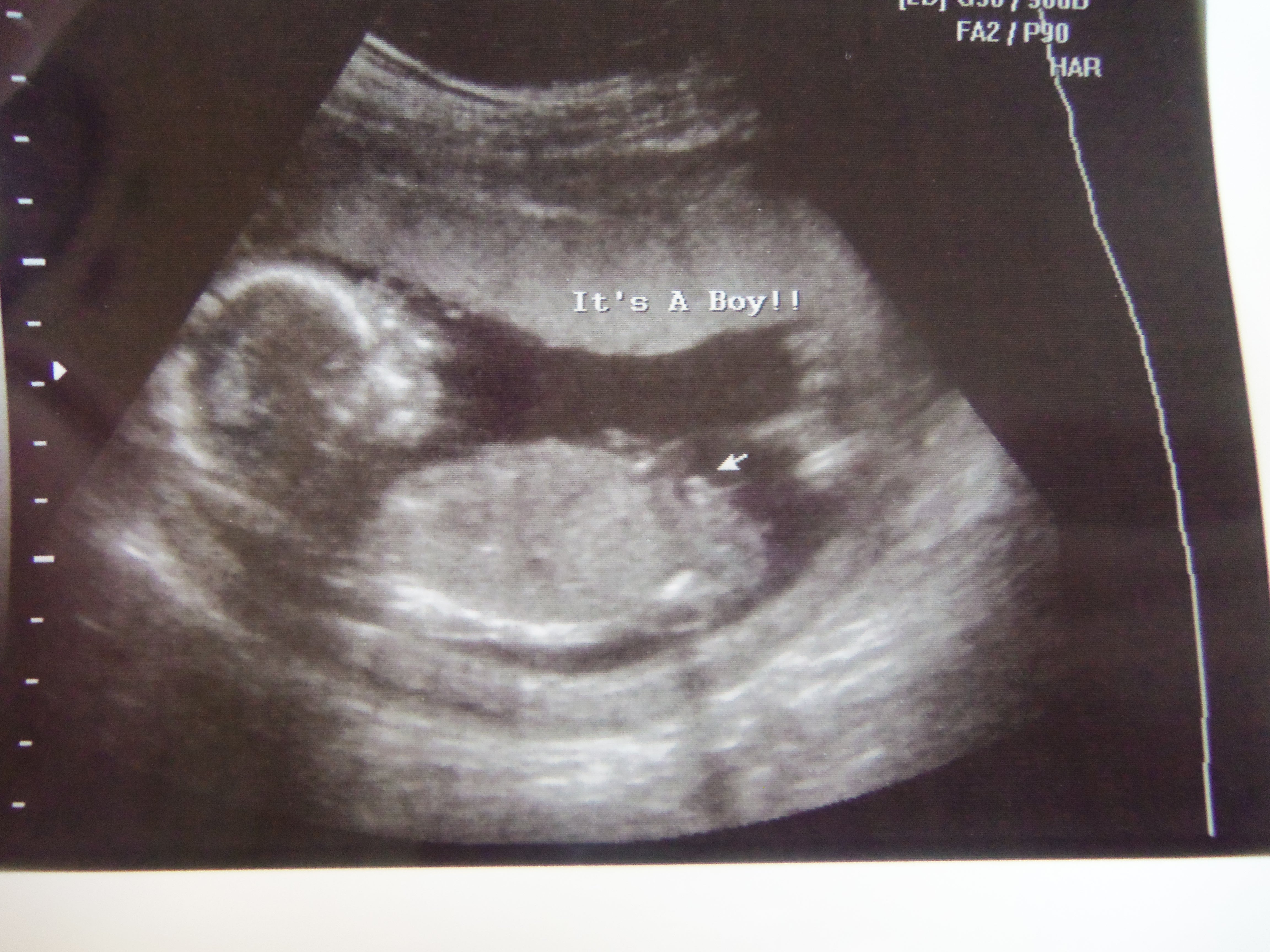 Name:  100_3819.JPG
Views: 218
Size:  2.98 MB