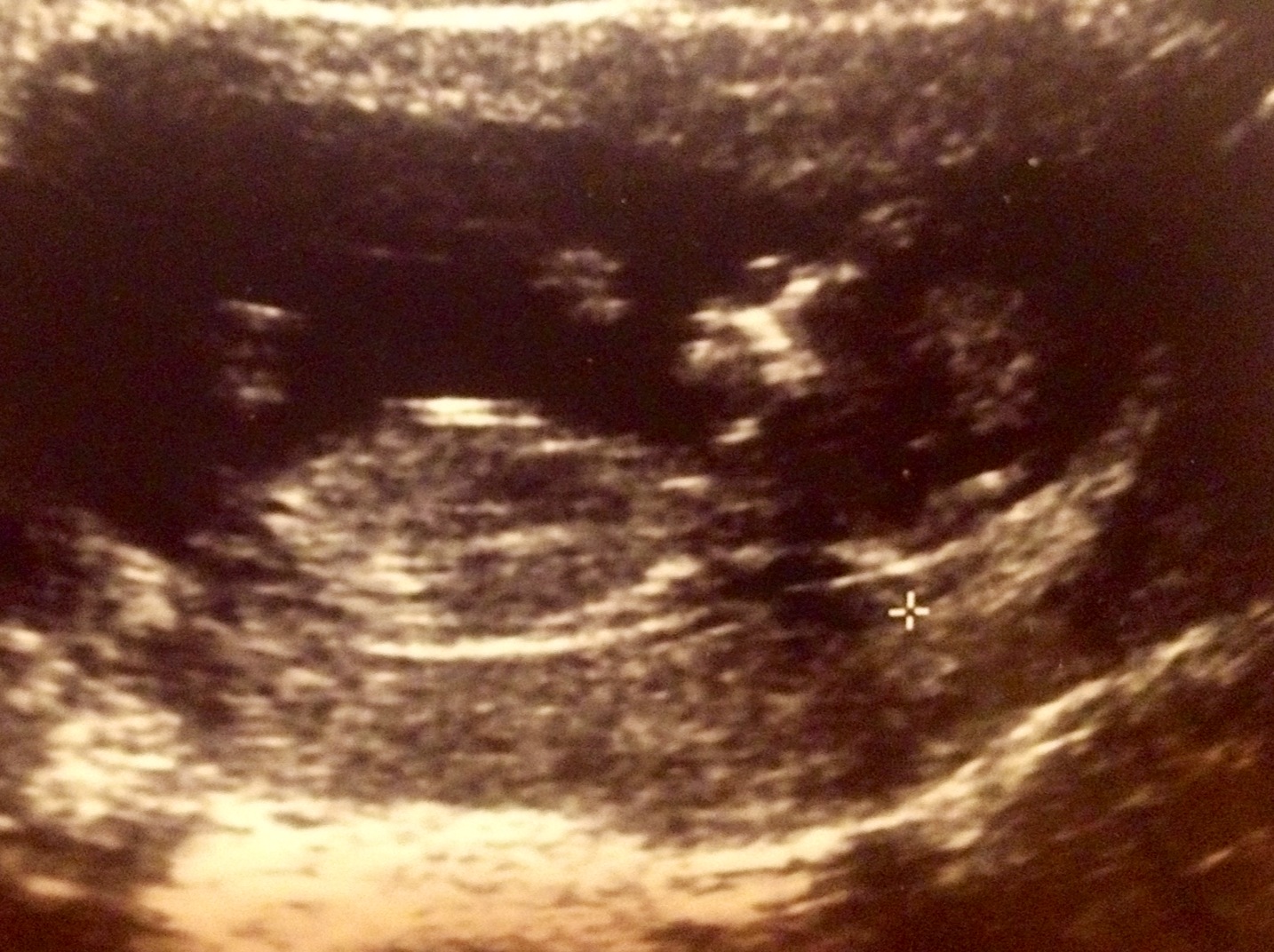Name:  baby1.JPG
Views: 125
Size:  422.6 KB