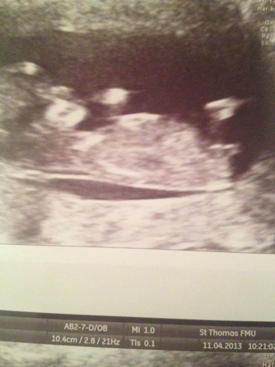 Name:  baby2.JPG
Views: 96
Size:  81.3 KB