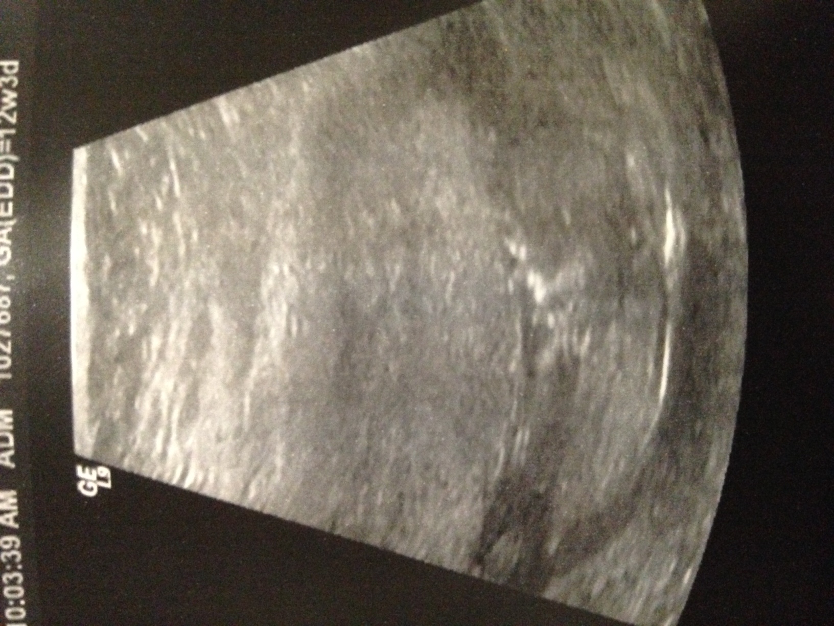 Name:  Spud12w.JPG
Views: 190
Size:  633.1 KB