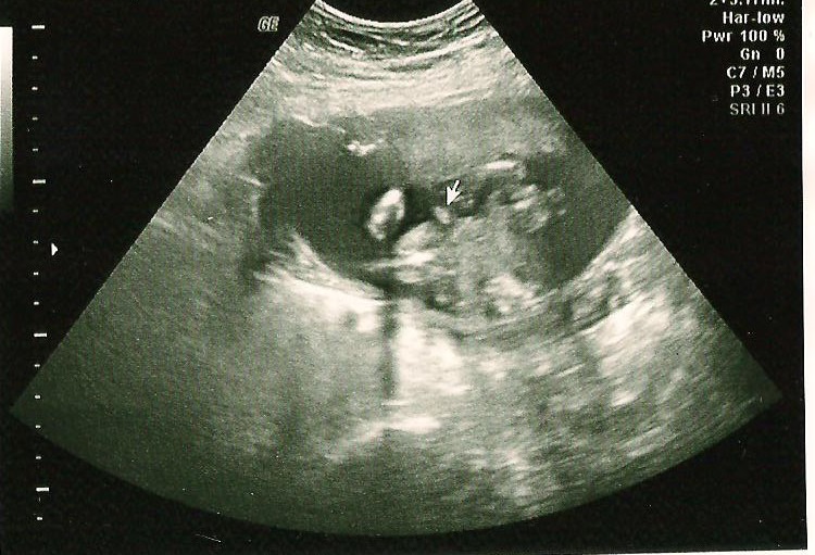Name:  boy bits name cut.jpg
Views: 506
Size:  161.8 KB
