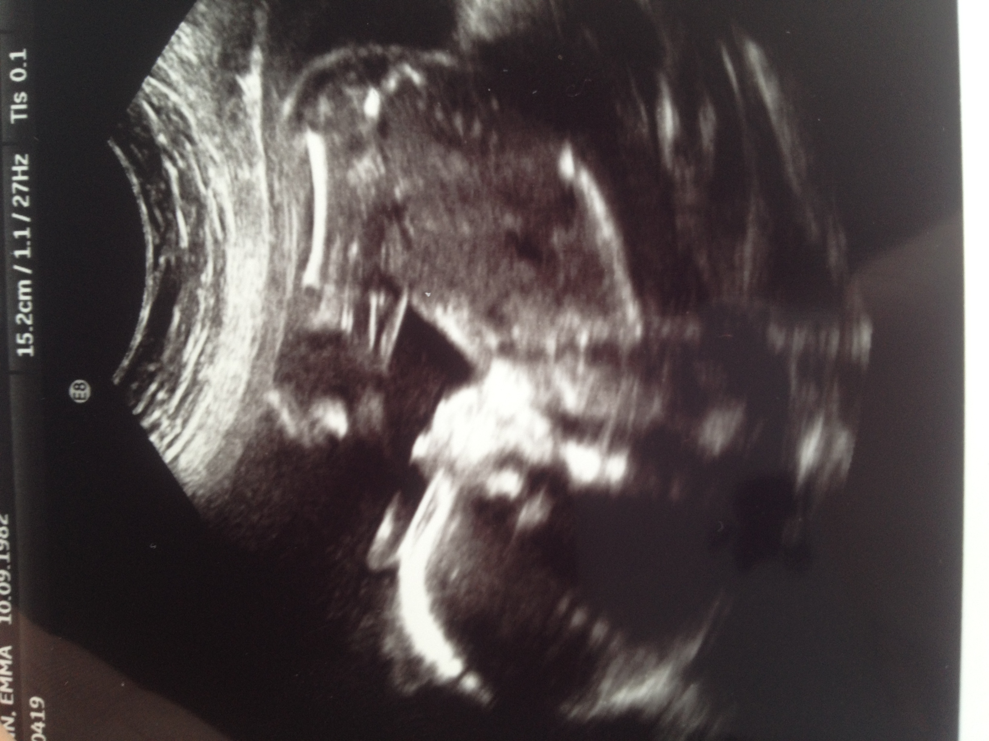 Name:  scan20wk.JPG
Views: 523
Size:  1.80 MB
