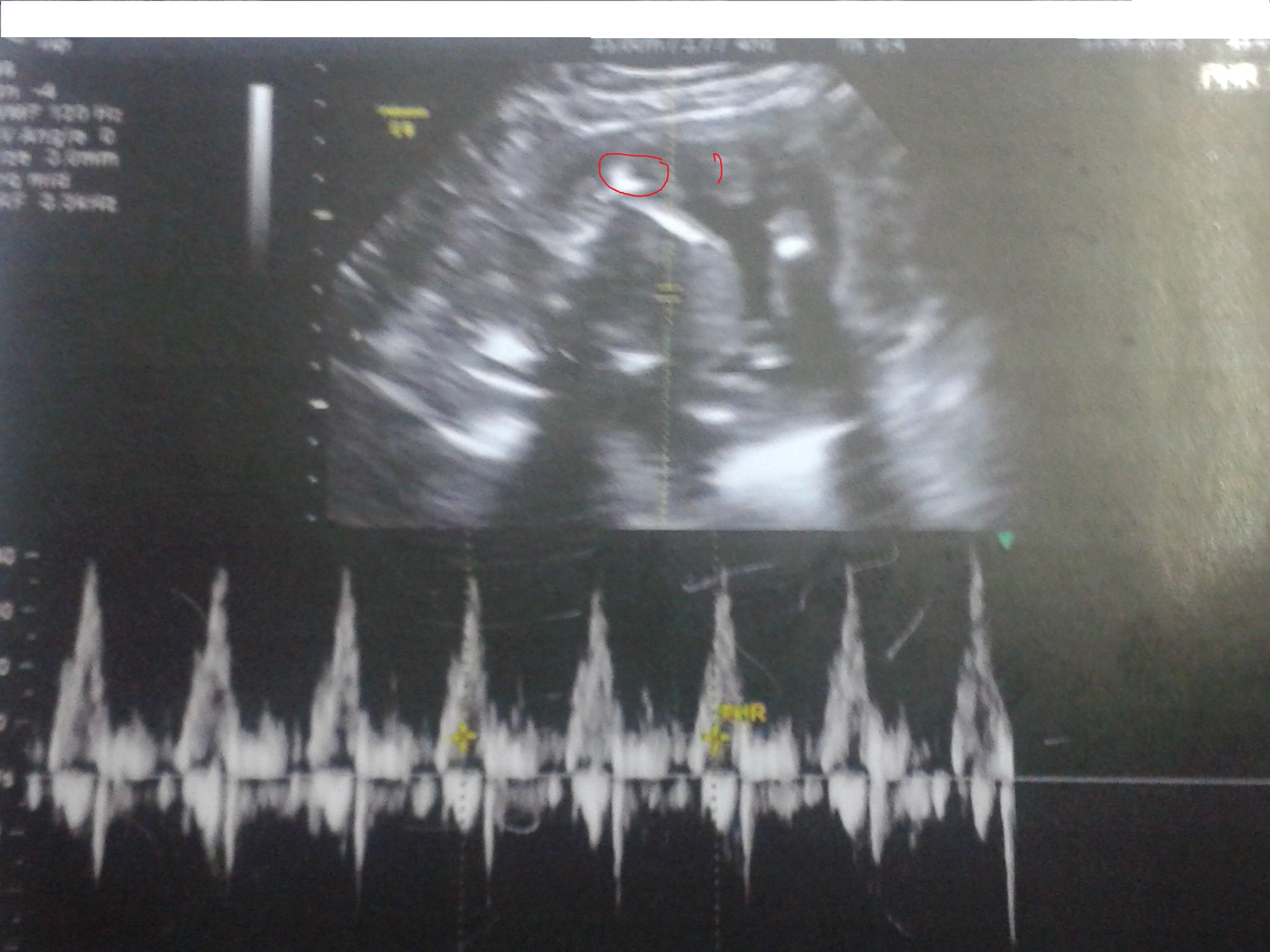 Name:  WP_000310.jpg
Views: 63
Size:  876.4 KB