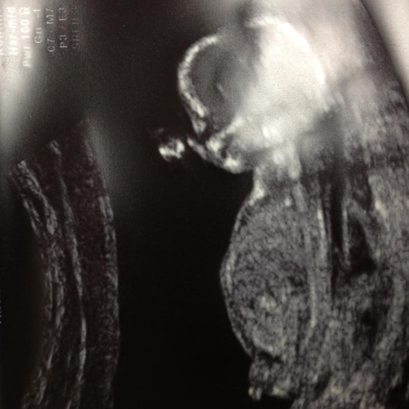Name:  babyg2.jpg
Views: 188
Size:  124.8 KB