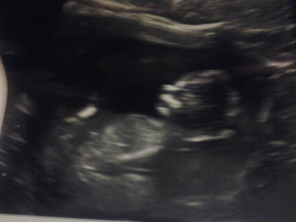 Name:  babypic.jpg
Views: 280
Size:  55.8 KB