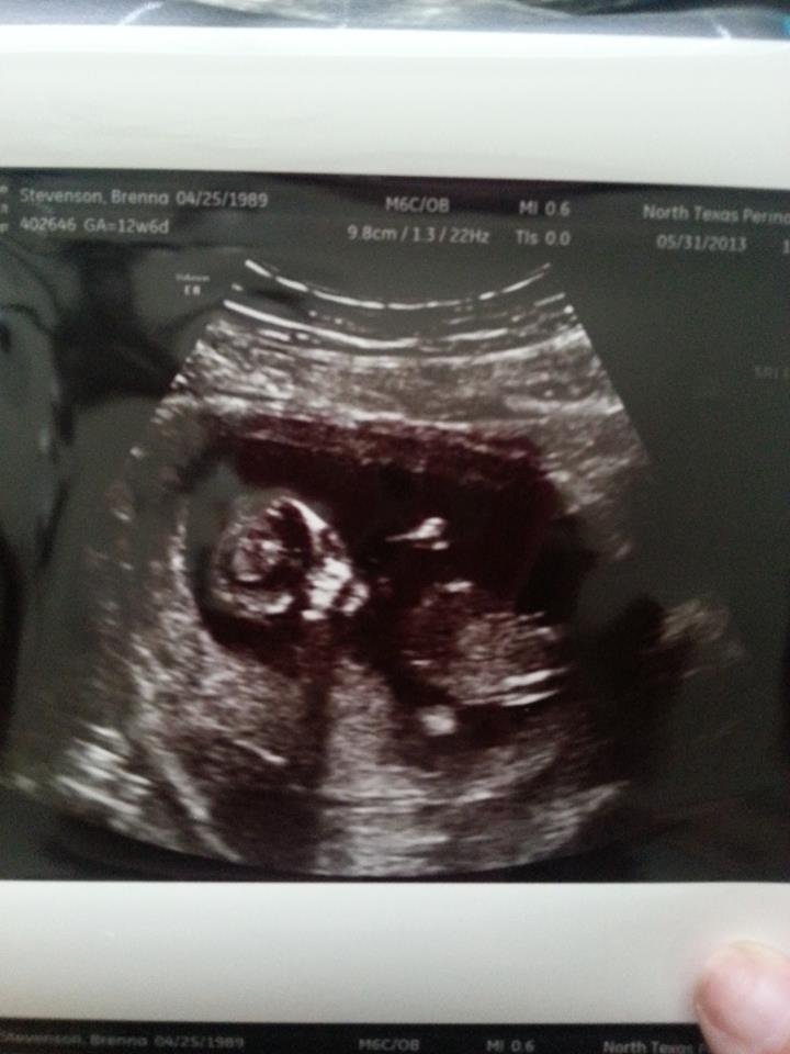 Name:  baby 12.6 weeks.jpg
Views: 202
Size:  59.9 KB