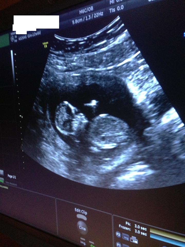 Name:  baby.jpg
Views: 199
Size:  143.6 KB