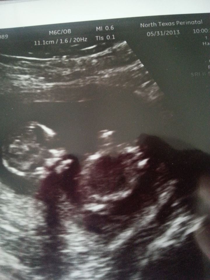 Name:  baby2.jpg
Views: 163
Size:  77.8 KB