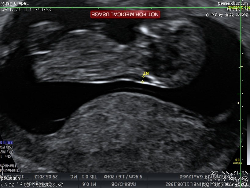 Name:  baby3.jpg
Views: 107
Size:  124.7 KB