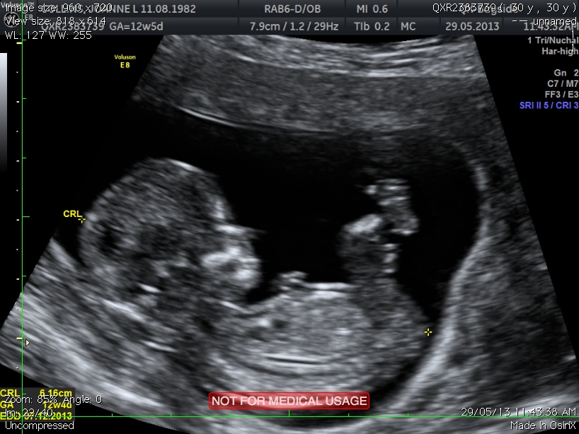 Name:  baby2.jpg
Views: 173
Size:  173.5 KB