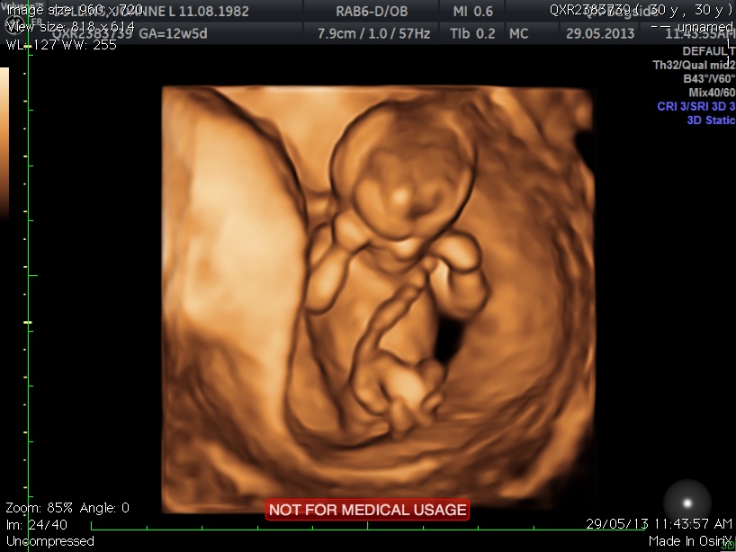 Name:  Scan.0024.jpg
Views: 376
Size:  127.9 KB